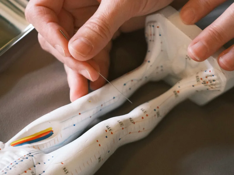 Acupuncture at Bluebonnet Chiropractic in Denver