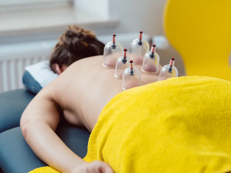 Cupping Therapy at Bluebonnet Chiropractic in Denver