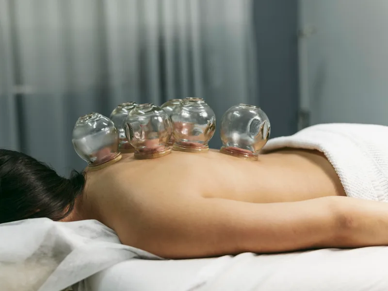Cupping Therapy at Bluebonnet Chiropractic in Denver