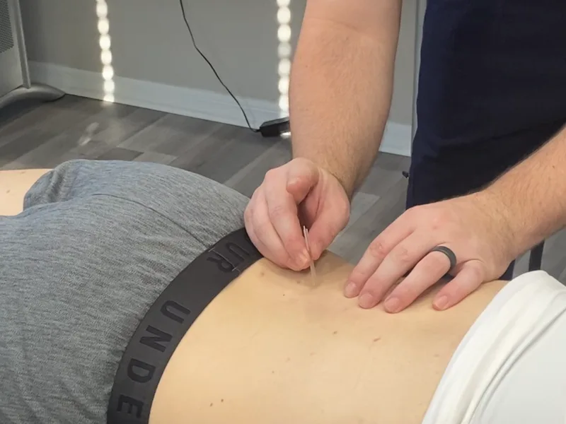 How Dry Needling works at Bluebonnet Chiropractic